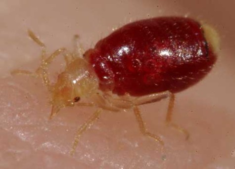 Students survive bed bug onslaught